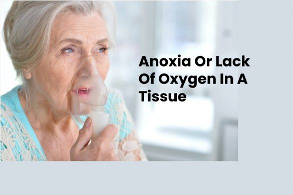 Anoxia Or Lack Of Oxygen In A Tissue