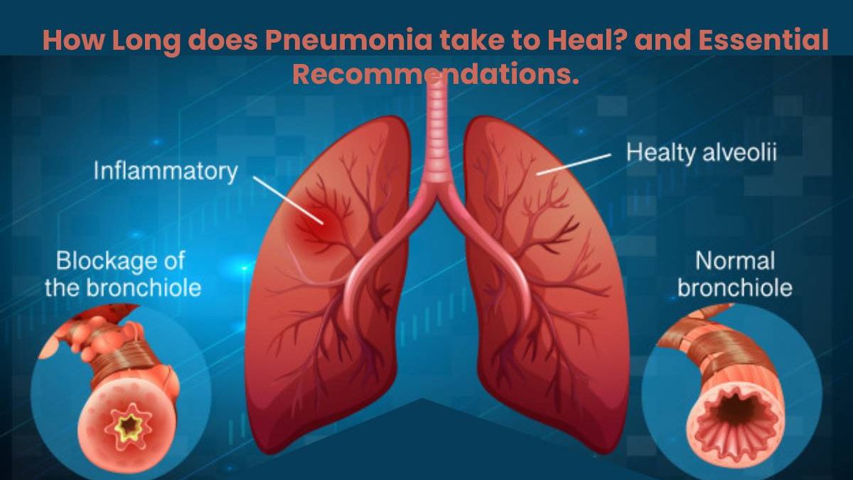 How Long does Pneumonia take to Heal? and Essential Recommendations.