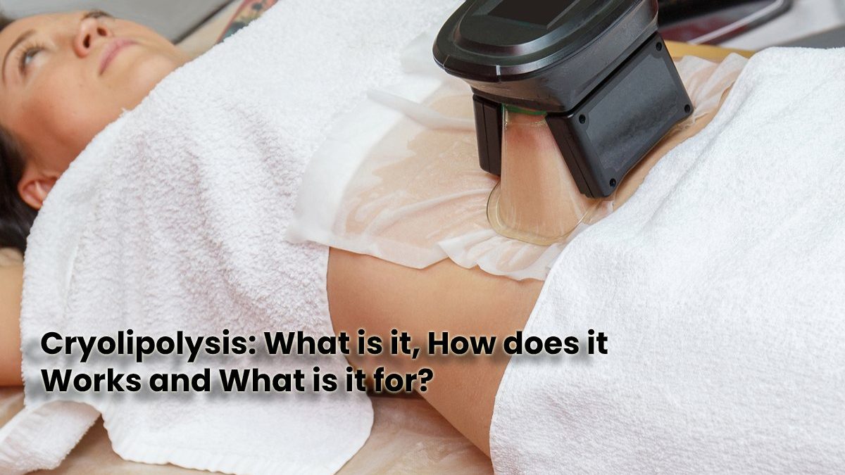 Cryolipolysis: What is it, How Does it Works and What is it for?