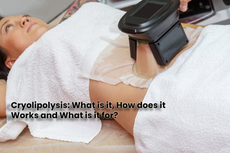 Cryolipolysis