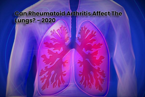 Rheumatoid Arthritis Affect the Lungs