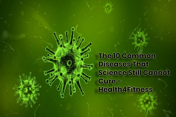 The 10 Common Diseases That Science Still Cannot Cure - Health4Fitness