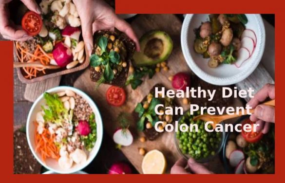 Colon Cancer - How to Prevent From Developing And Early Diagnosis