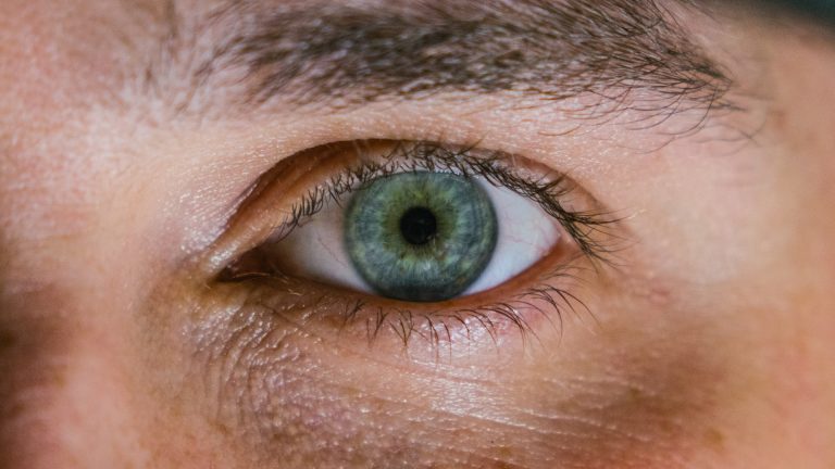Why do you have Dry Eyes - Health4Fitness [2020]