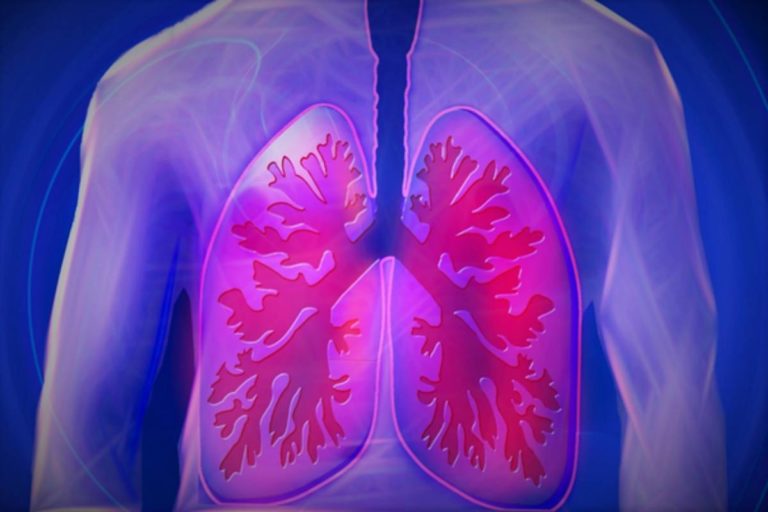 Lung Diseases