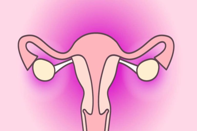 Surgical Menopause