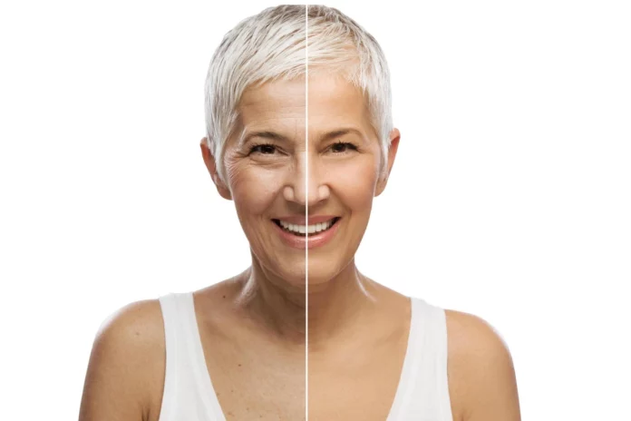Aging