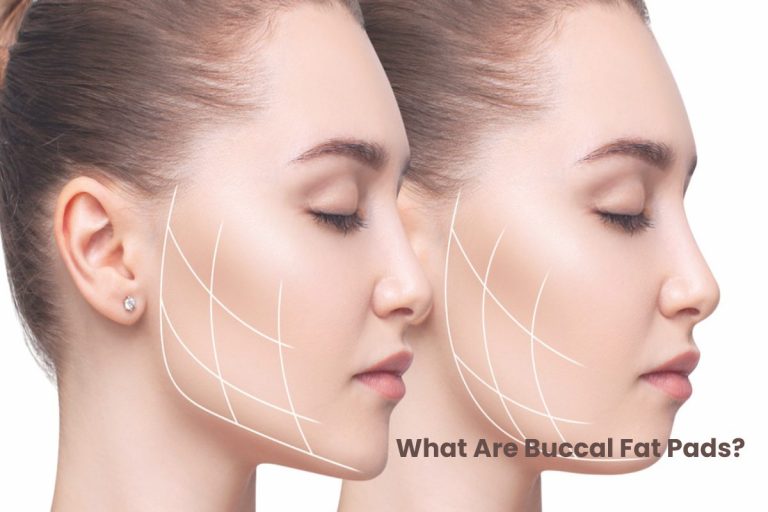 What Are Buccal Fat Pads?