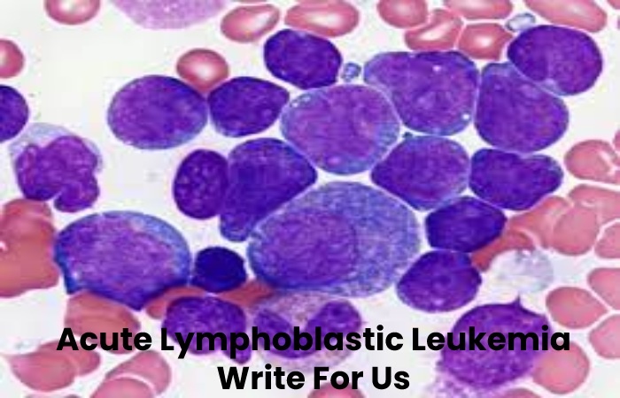 Acute Lymphoblastic Leukemia Write For Us