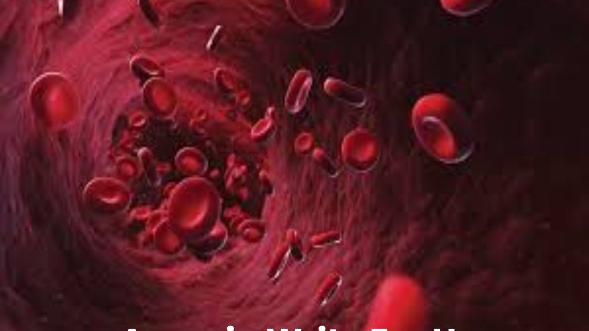 Anemia Write For Us