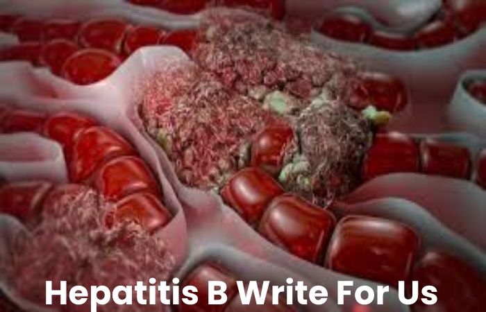 Hepatitis B Write For Us