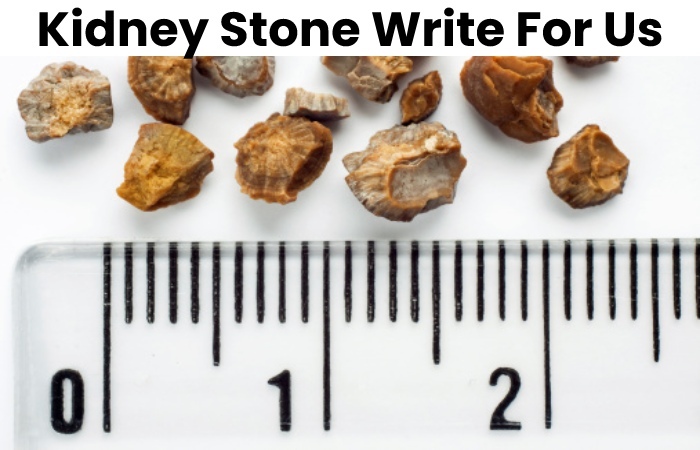 Kidney Stone Write For Us