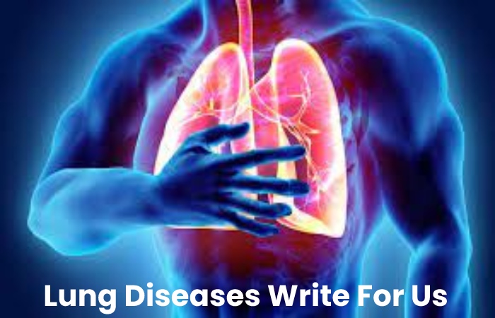 Lung Diseases Write For Us