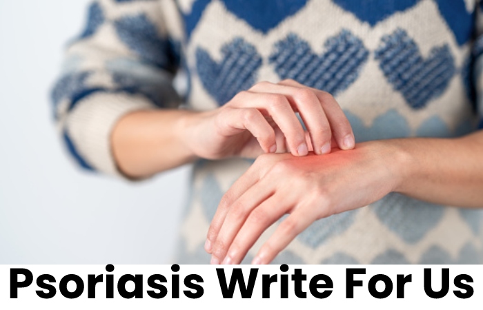 Psoriasis Write For Us