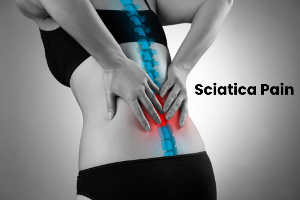 Sciatica Pain Write For Us