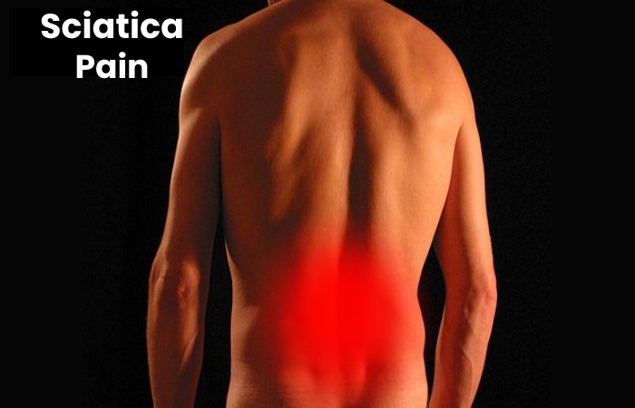 Sciatica Pain Write For Us