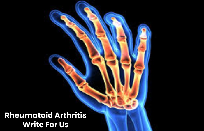 Rheumatoid Arthritis Write For Us