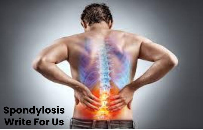 Spondylosis Write For Us