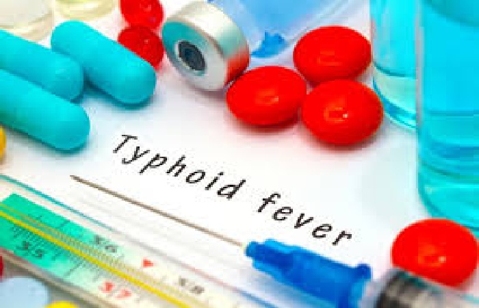 Typhoid Write For Us