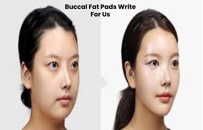 Buccal Fat Pads Write For Us