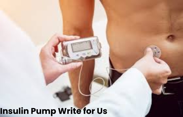 Insulin Pump Write for Us