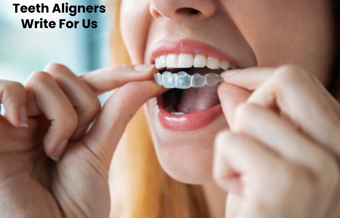 Teeth Aligners Write For Us