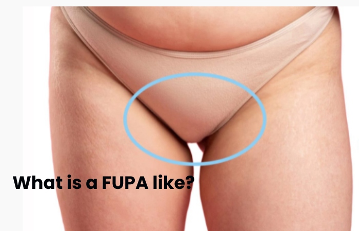 liposuction pubic area- What is a FUPA like