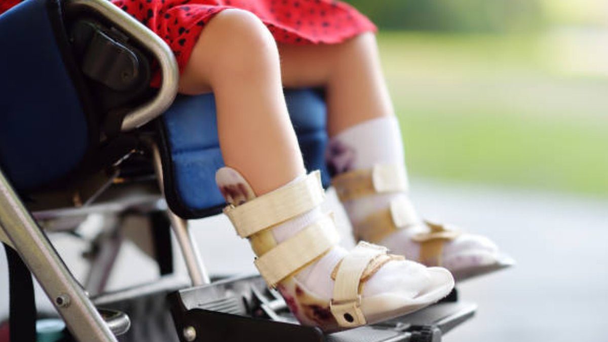 The Definitive Guide to Types of Cerebral Palsy in Kids
