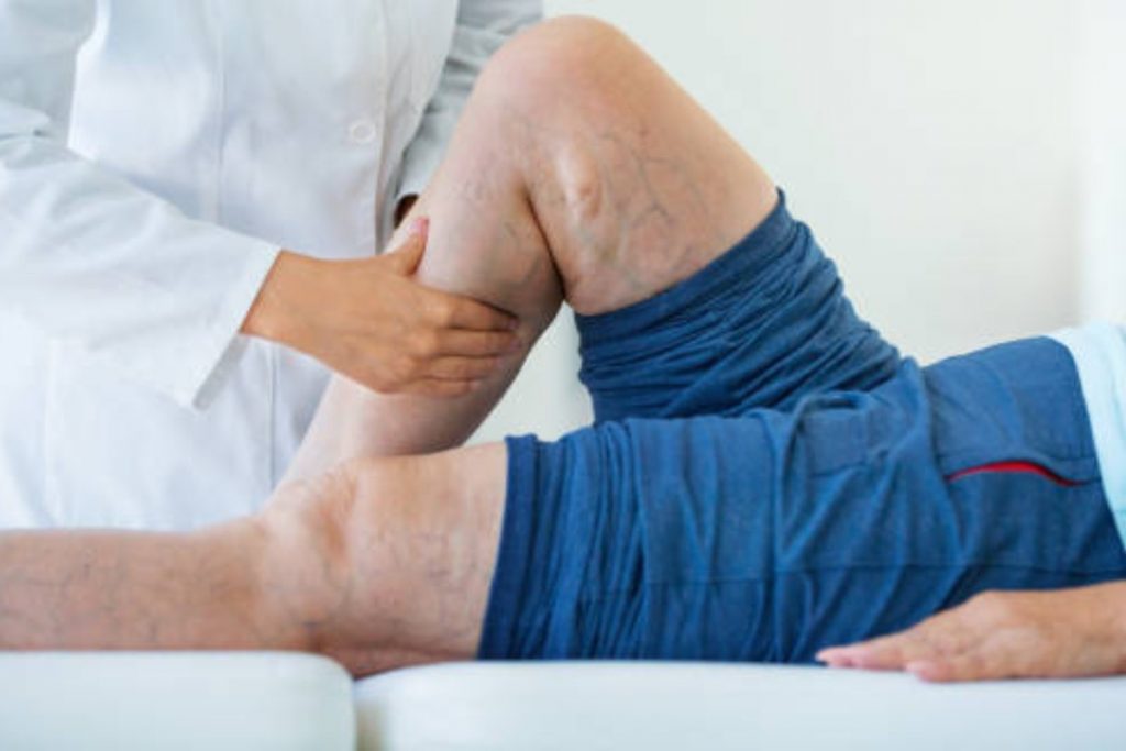 https://www.health4fitnessblog.com/varicose-veins-write-for-us/