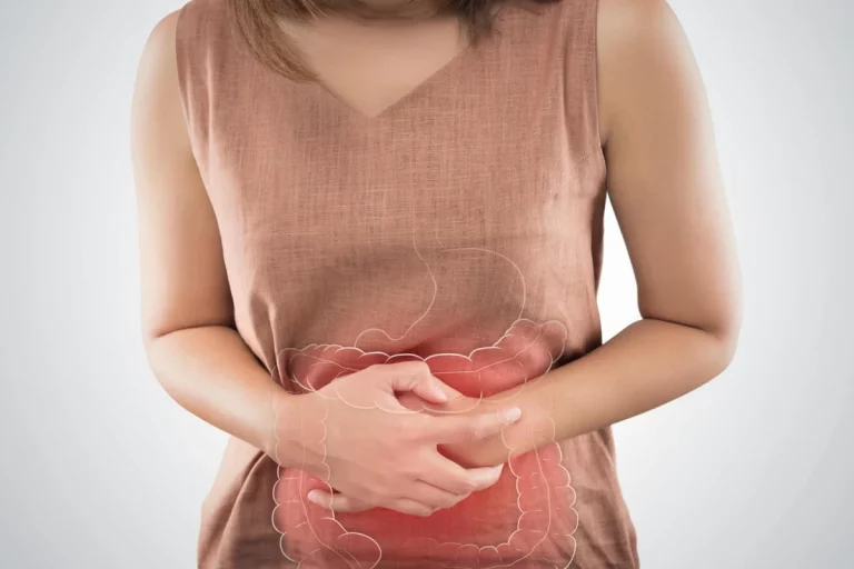 How to Improve Digestive Health Remedies
