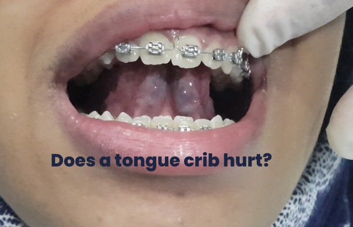 Does a tongue crib hurt?