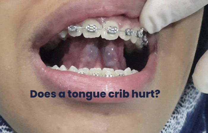 5 Reasons To Use A Tongue Crib For Better Sleep bite-your-tongue-than-eat-your-words-imgflip