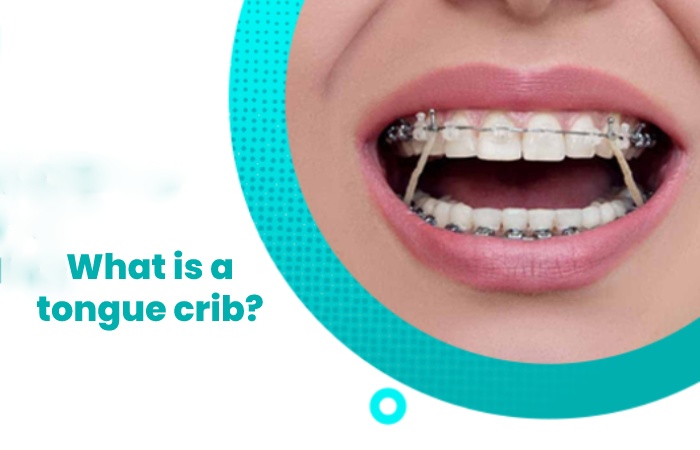 What is a tongue crib?