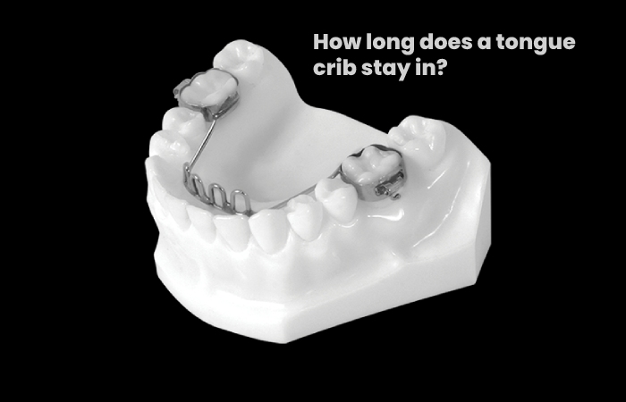 How long does a tongue crib stay in?