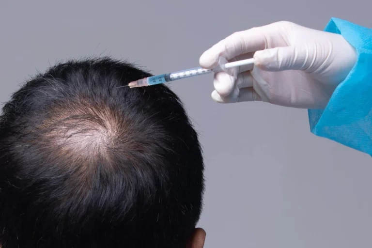 Hair Transplant Cost Turkey: A Comprehensive Guide