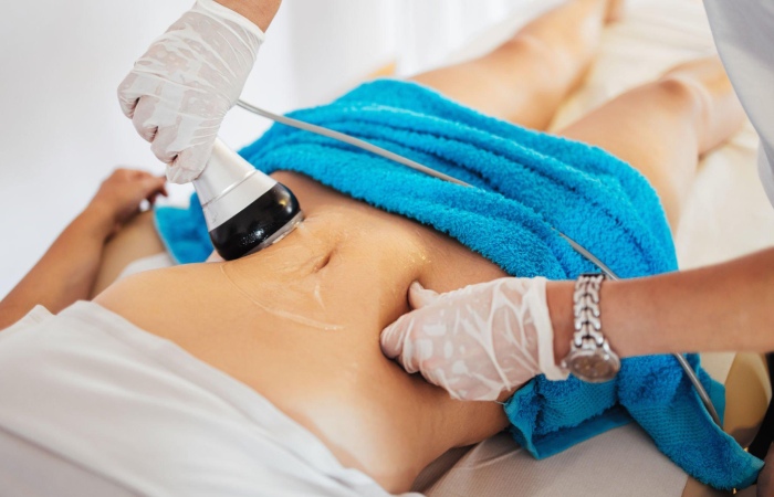 Lipo Cavitation Write For Us