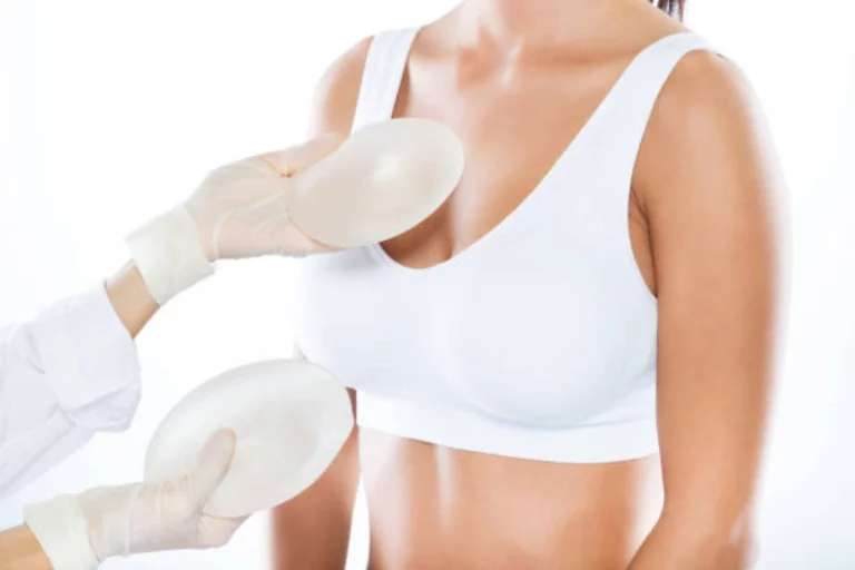 Your Implant-Based Breast Reconstruction FAQ