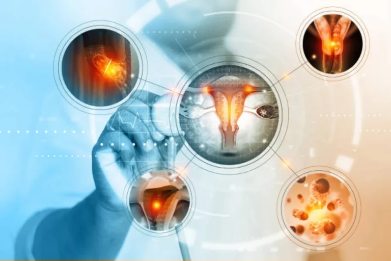 Understanding Female Genital Surgery