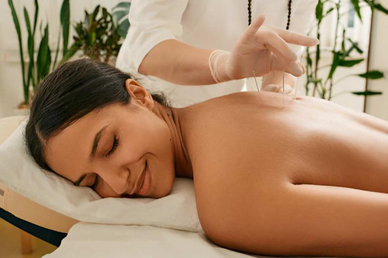 Here is what You Should Know About Acupuncture Therapy