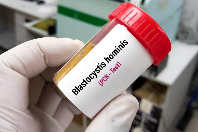 Blastocystis Hominis: What You Need to Know