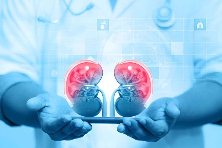 5 Natural Approaches to Support Kidney Stone Management