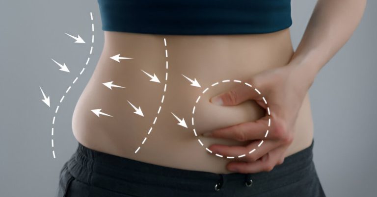 Are You An Ideal Candidate For Tummy Tuck Surgery?