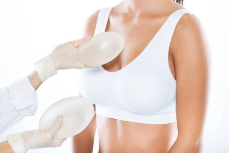Implant-Based Breast Reconstruction: A Clear Guide for Patients