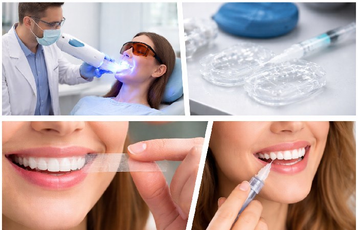 Comparison of professional whitening, custom trays, whitening strips, and whitening pen