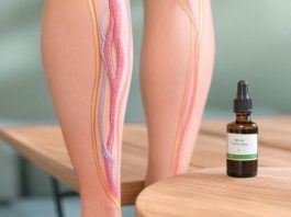 Varicose Veins