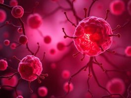 Mononucleosis