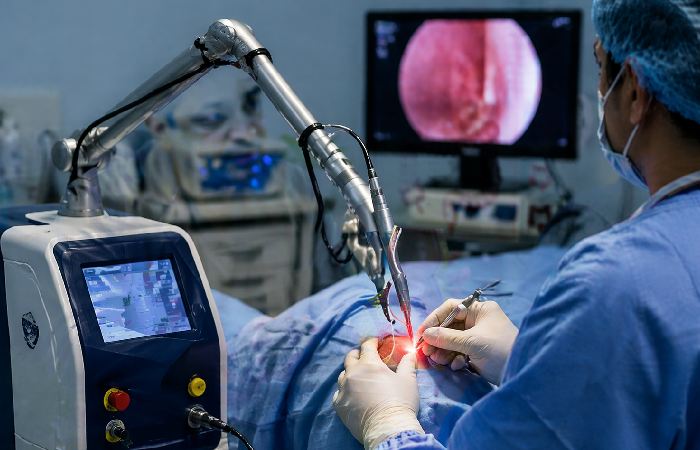 Laser equipment used for piles treatment in clinic